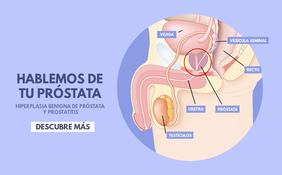 Hiperplasia benigna de próstata (HBP) y prostatitis: Síntomas, diferencias y tratamiento